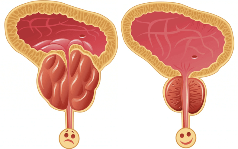 男性性能力问题的原因